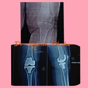 Photo : Dr. Jagdish Dhake