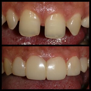 Image Gallery | SMILE GALLERY DENTAL CARE CENTRE | Erandwana, Pune Image Gallery | SMILE GALLERY DENTAL CARE CENTRE | Erandwana, Pune