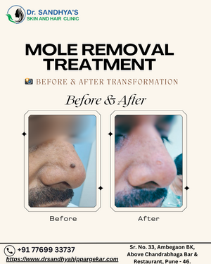 Befor and After Transformation