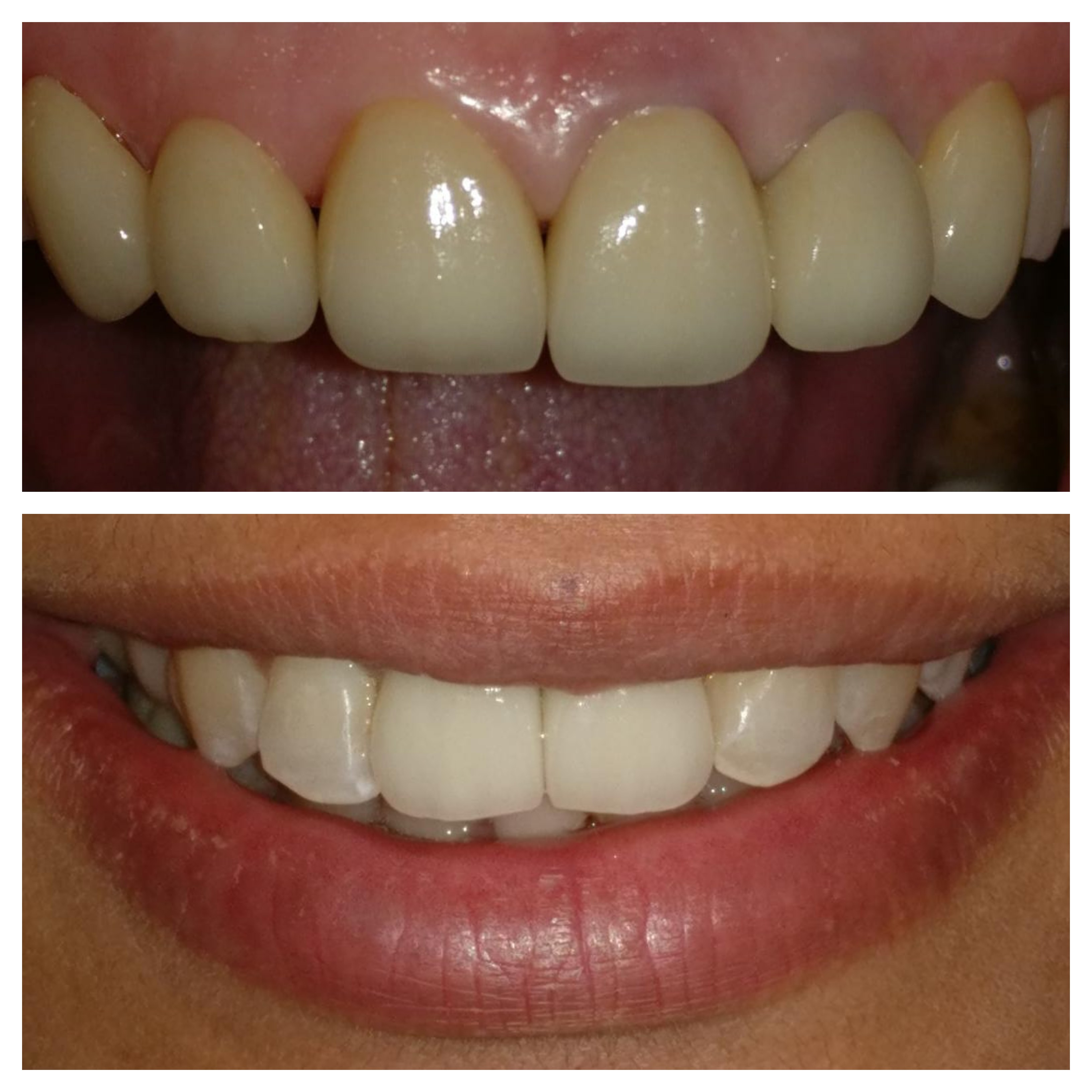 Image Gallery | SMILE GALLERY DENTAL CARE CENTRE | Erandwana, Pune